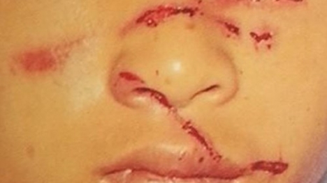 Bố đánh con dã man vì... làm sổng trâu: Công an hình sự vào cuộc